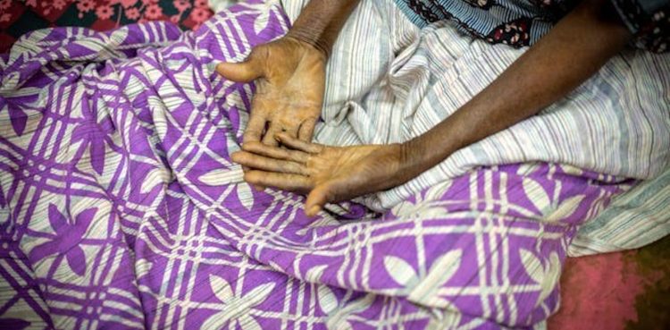 VIH : les Africains âgés, grands oubliés des soins et de la recherche